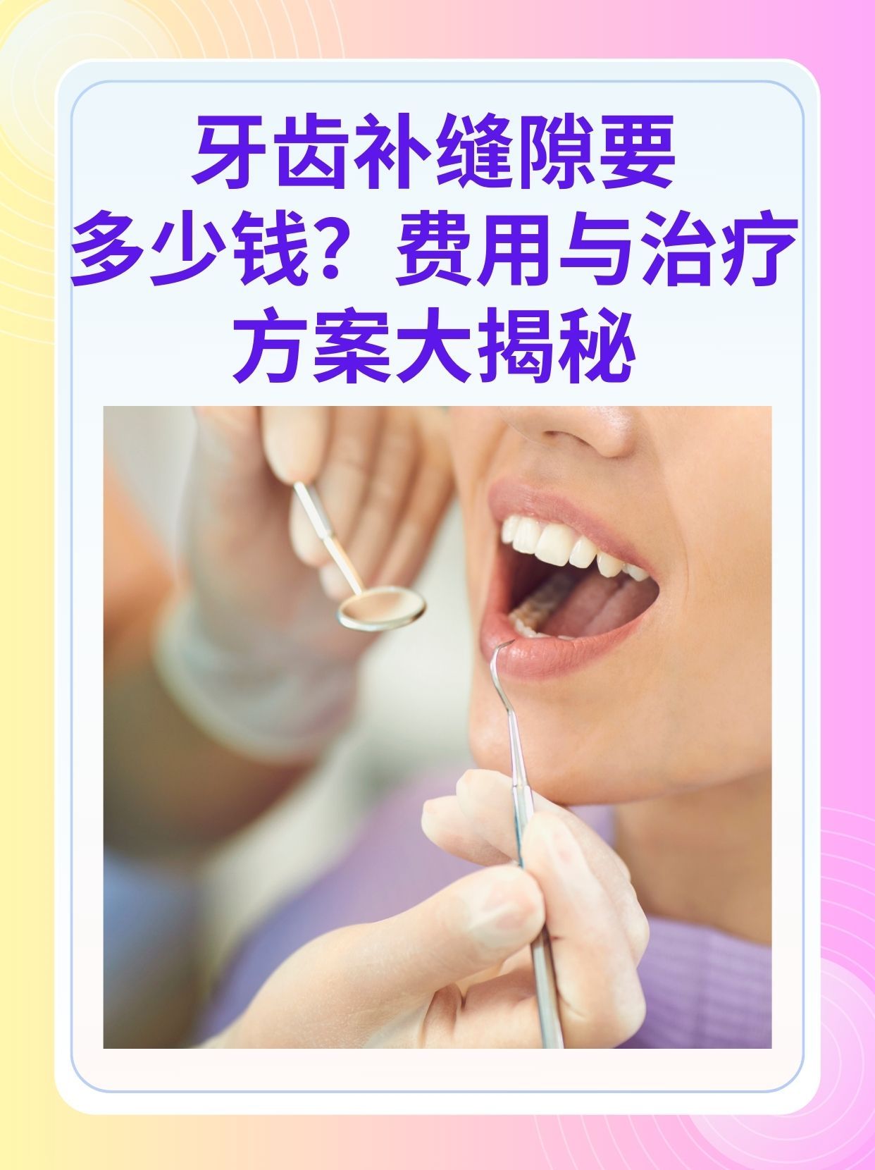 丹东补牙医保可以报销吗(补牙医保可以报销吗 哪些可以报销呢)